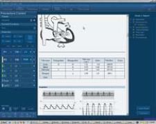 Mckesson horizon software